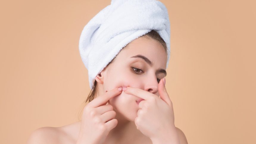 5 easy home remedies to remove blackheads on cheeks