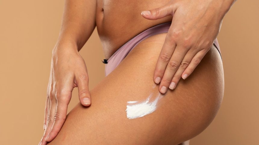 5 effective home remedies to get rid of stretch marks on buttocks