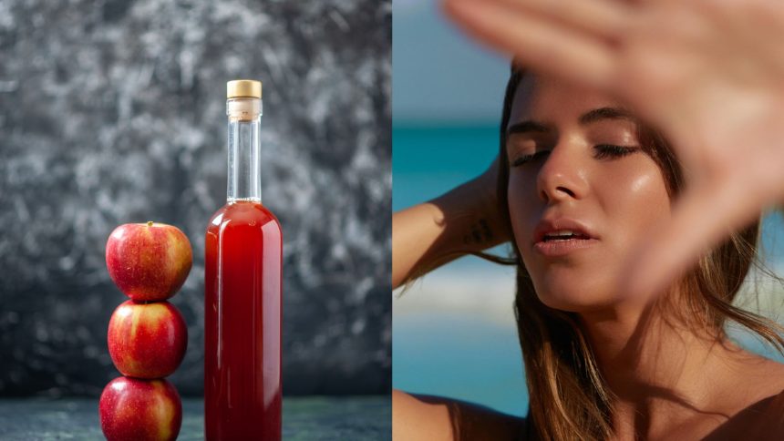 Is apple cider vinegar a good home remedy for sunburn?